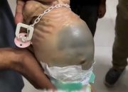 ‎Bayi di Gaza Meninggal Akibat Kelaparan, Krisis Kemanusiaan Makin Parah