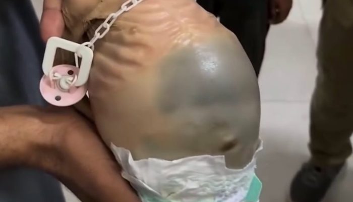 ‎Bayi di Gaza Meninggal Akibat Kelaparan, Krisis Kemanusiaan Makin Parah