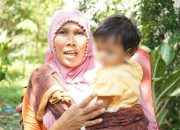 Wali Kota Medan, Senyum, dan Sumbing yang Tuntas