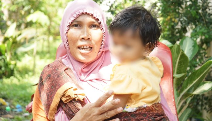 Wali Kota Medan, Senyum, dan Sumbing yang Tuntas