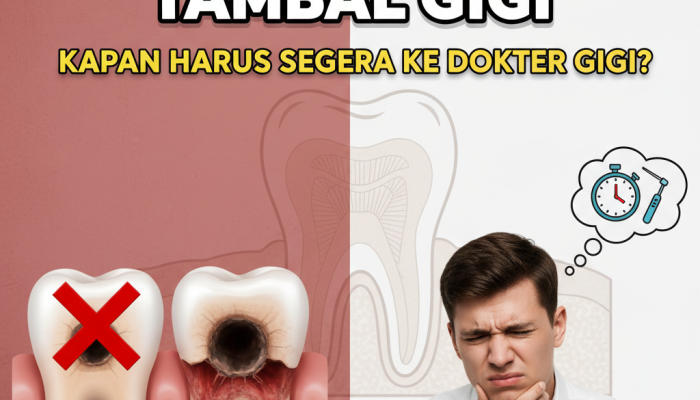 ‎Bahaya Menunda Tambal Gigi: Kapan Harus Segera ke Dokter Gigi?