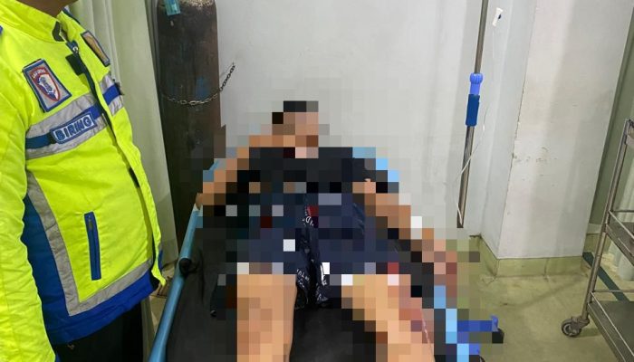Sama-sama Tak Pakai Helm dan Satu Pengendara Masih di Bawah Umur, Dua Sepeda Motor Adu Banteng di Sergai